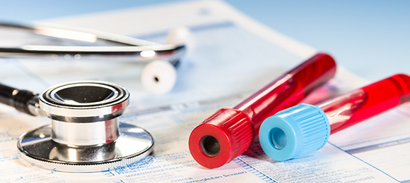 내시경 검사실 이미지