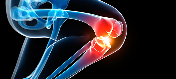 체외충격파 치료 관련 이미지