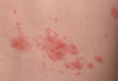 안면 통증 상담 관련 이미지